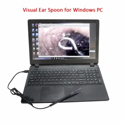 USB Ear Cleaning Tool HD Visual Ear Spoon