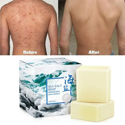 Goat Milk Soap Sea Salt Removal Pimple Pores Acne Treatment Handmade Moisturizing Cleaner Face Care For Travel Wash Basis 100G M