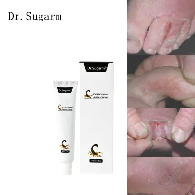 Foot Care Cream Foot Herbal Detox Anti Fungal Infection Onychomycosis Fungus Treatment Cream