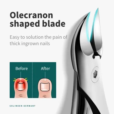 MR GREEN Nail Clippers Toenail Cutters Pedicure Manicure Tools Anti Splash Ingrown Paronychia Professional Correction Tool Sets