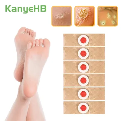 30pcs Foot Care Medical Plaster Foot Corn Removal Calluses Plantar Warts Thorn Plaster Health Care Pain Relief Pads Patches A175