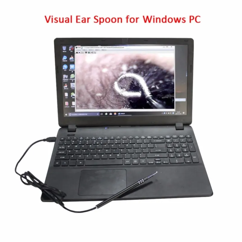 USB Ear Cleaning Tool HD Visual Ear Spoon