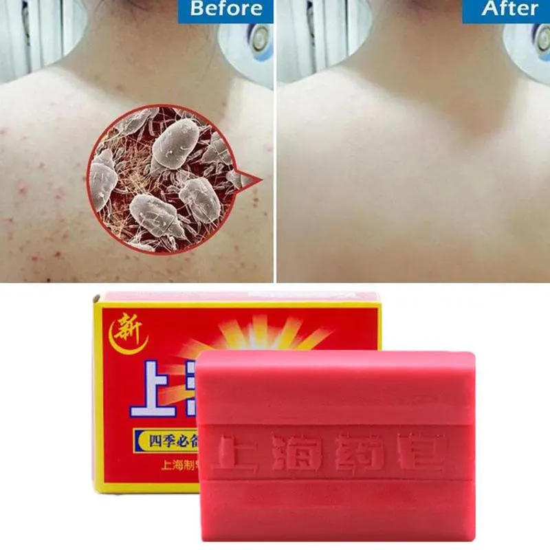 90g Red China Medicated Soap Conditions Acne Psoriasis Seborrhea Eczema Anti Fungus Bath Healthy Soap Slimming Body Cream