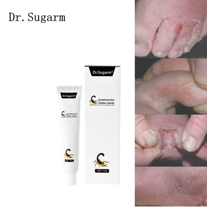 Foot Care Cream Foot Herbal Detox Anti Fungal Infection Onychomycosis Fungus Treatment Cream