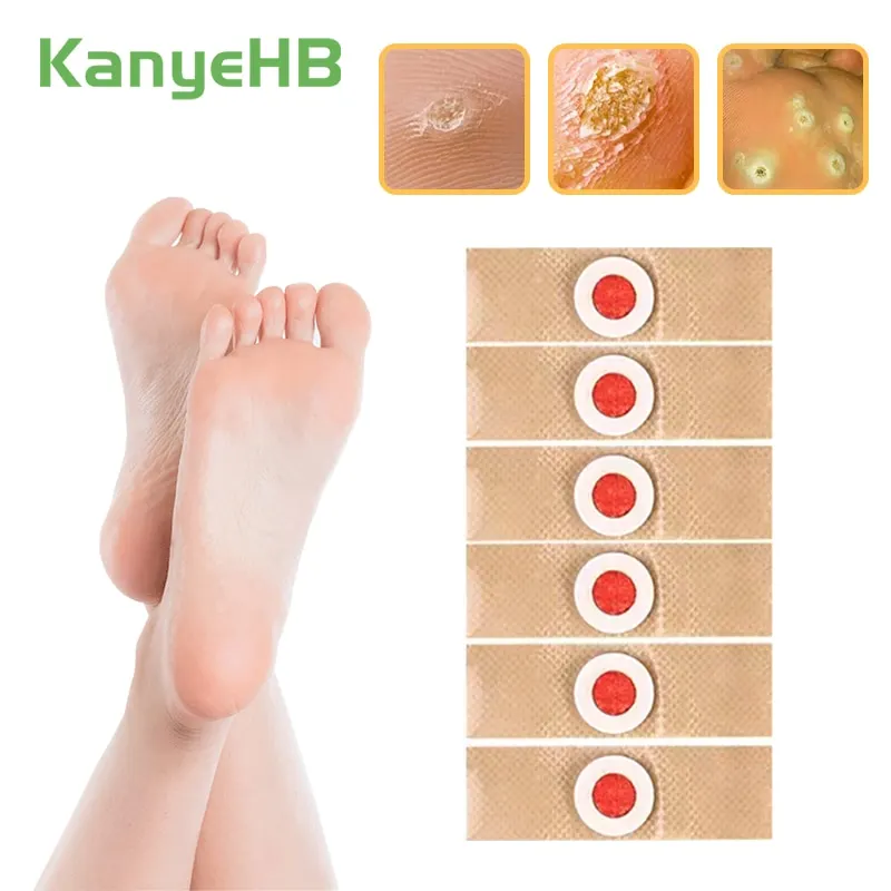 30pcs Foot Care Medical Plaster Foot Corn Removal Calluses Plantar Warts Thorn Plaster Health Care Pain Relief Pads Patches A175