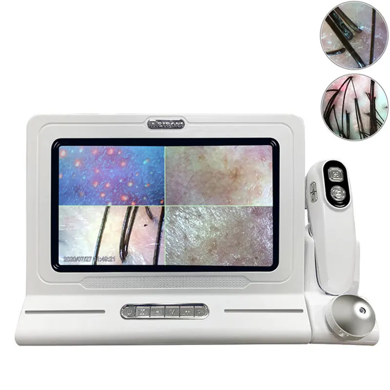 11 Inch Professional High Quality HD Hair Follicles Scalp Scanner Detector Hair Analyzer / Skin And Scalp Hair Analysis Machine