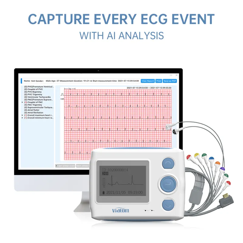 Medical Wearable 12 Leads Holter Monitor AI Smart Dynamic Analysis System Machine ECG Device 24H EKG Recording free PC Software
